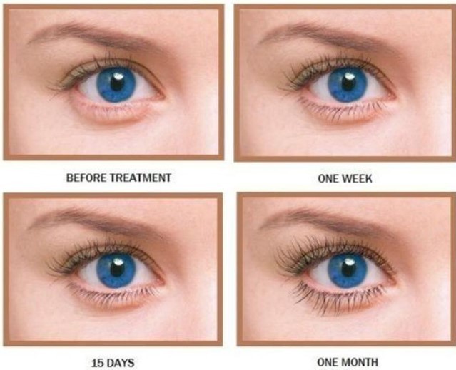 Kirpik Kaş Büyümesi Sıvısı 5ml Lashtonic Formulation No Side Effects Growth Serum 8