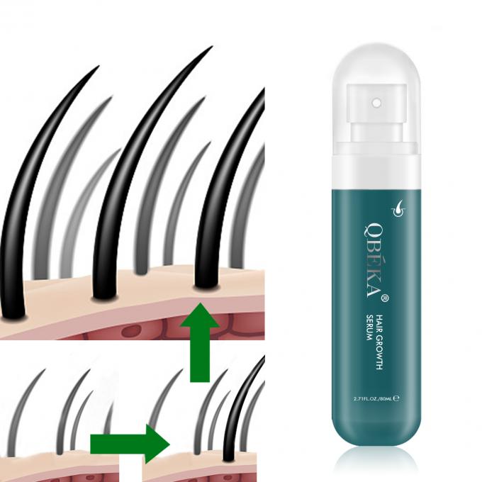 80ml Saç Büyütme Yağı Özel Etiket Ürün Profesyonel QC Ekibi Saç dökülmesi karşıtı serum 0
