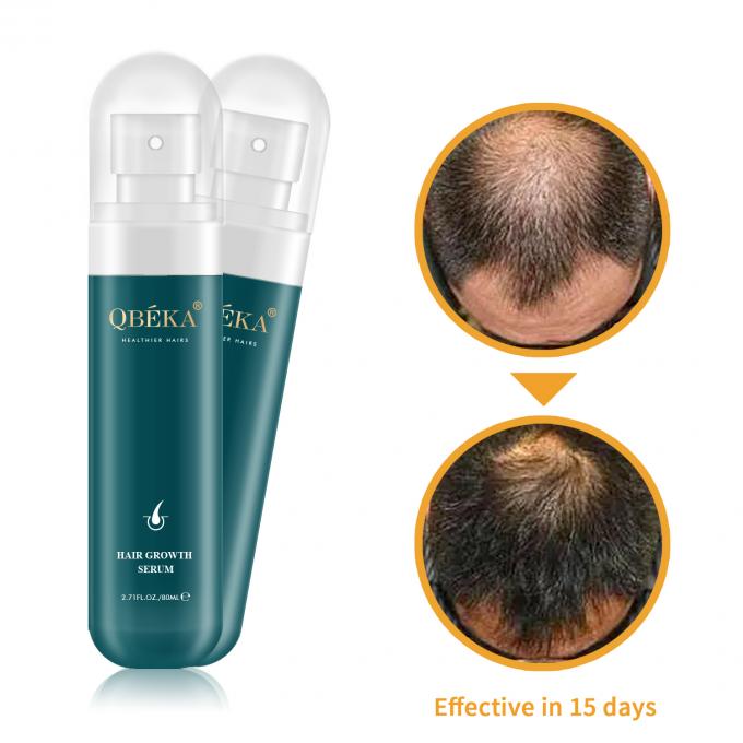 80ml Saç Büyütme Yağı Özel Etiket Ürün Profesyonel QC Ekibi Saç dökülmesi karşıtı serum 1