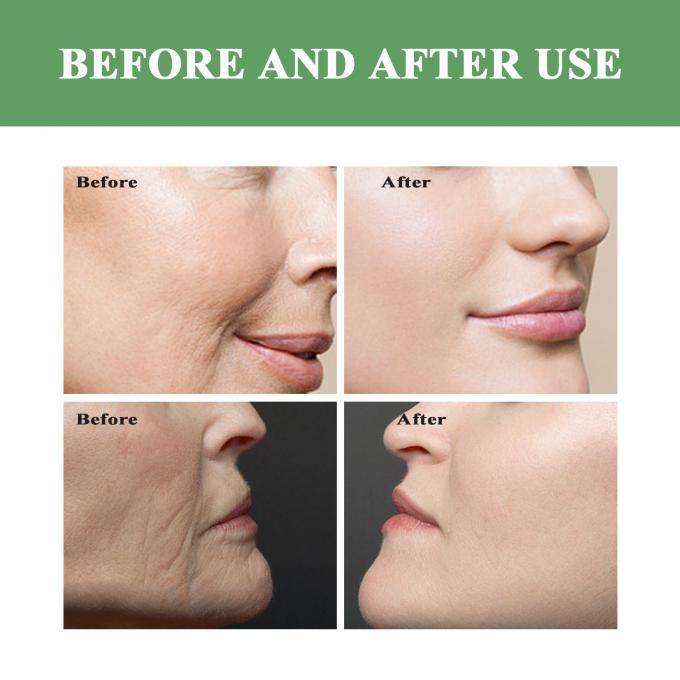 Normal Boyutlu Yüz Toner Özel Etiket İhtiyaçları İçin Organik Karışıklık kaldırma Toner 7