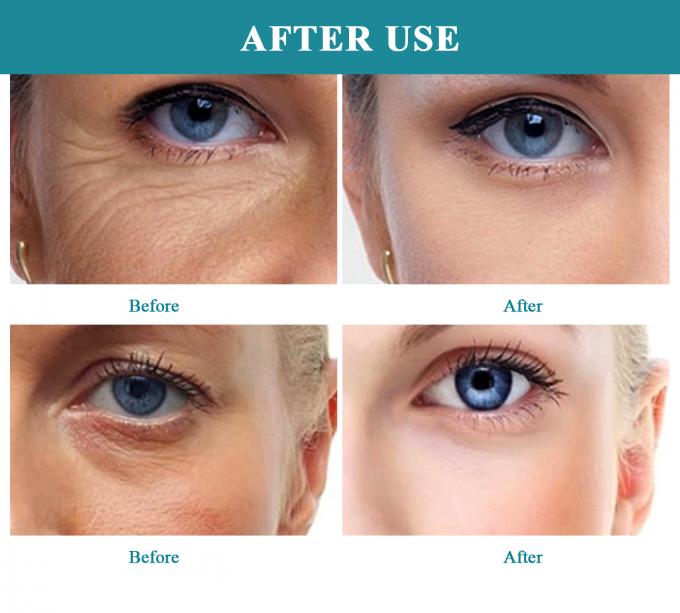 Hidratasyon ve solgunluk karanlık noktaları için hafif All-in-One Serum özelleştirilebilir formül 4