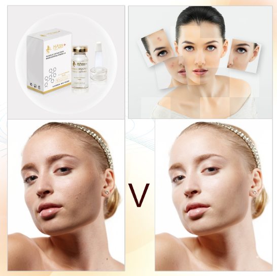 Normal Boyutlu Organik C Vitamini Temizleyici Beyazlatıcı Freckles Anti Ampuller miktarı 1000 1