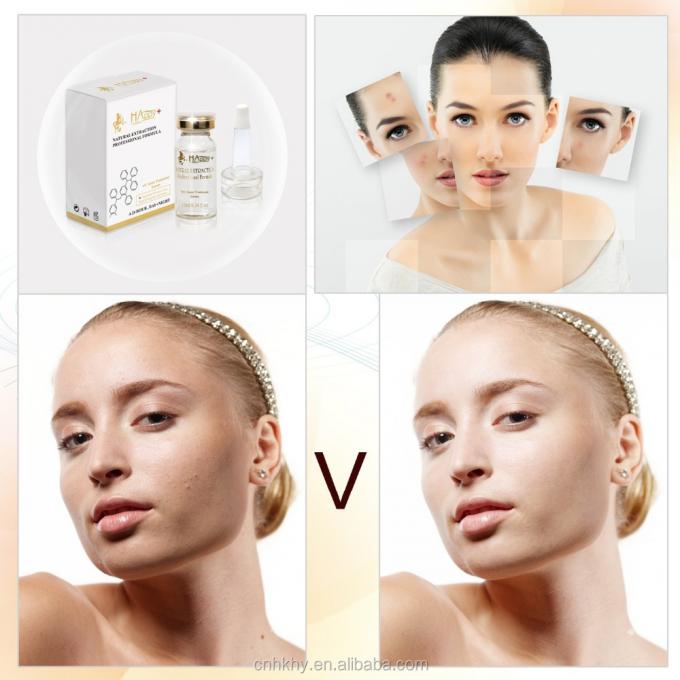 QBEKA Happy Cosmetics Levorotatory VC Original Liquid Bio Serum ile sivilce yara izlerini kaldırın. 0